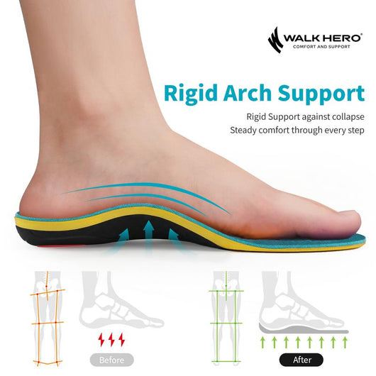 AllDay™ Support Insoles