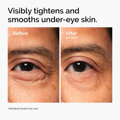 EyeRenew™ PDRN Eye Cream