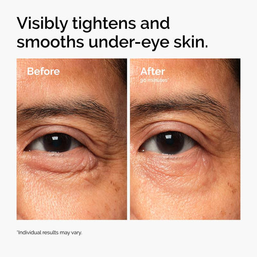 EyeRenew™ PDRN Eye Cream