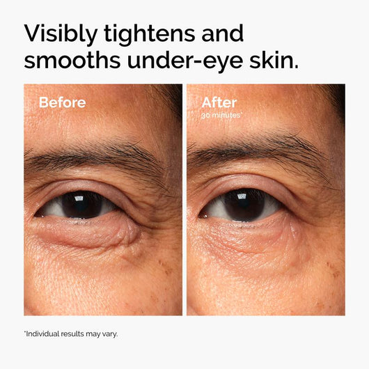 EyeRenew™ PDRN Eye Cream