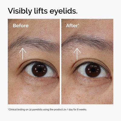 EyeRenew™ PDRN Eye Cream