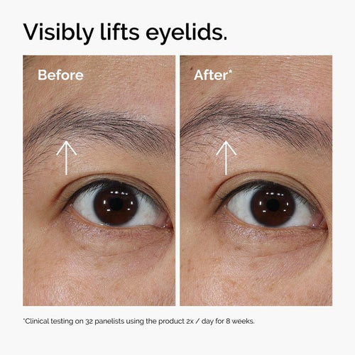 EyeRenew™ PDRN Eye Cream