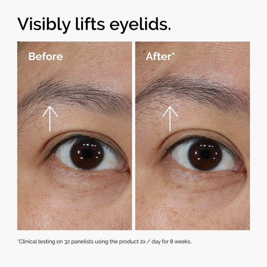 EyeRenew™ PDRN Eye Cream