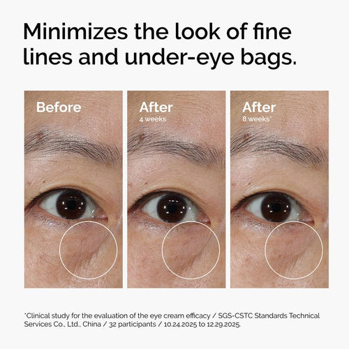 EyeRenew™ PDRN Eye Cream