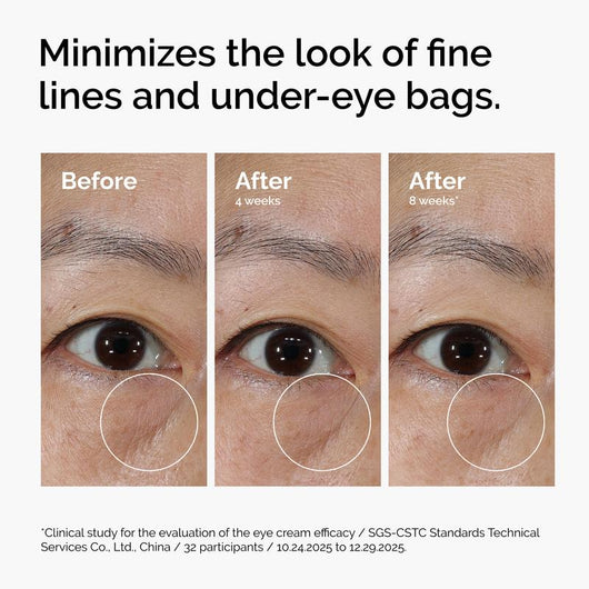 EyeRenew™ PDRN Eye Cream